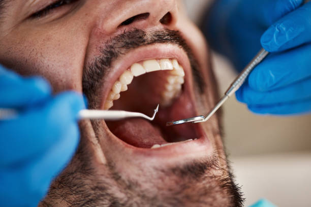 Best Wisdom Tooth Removal  in Wellington, KS